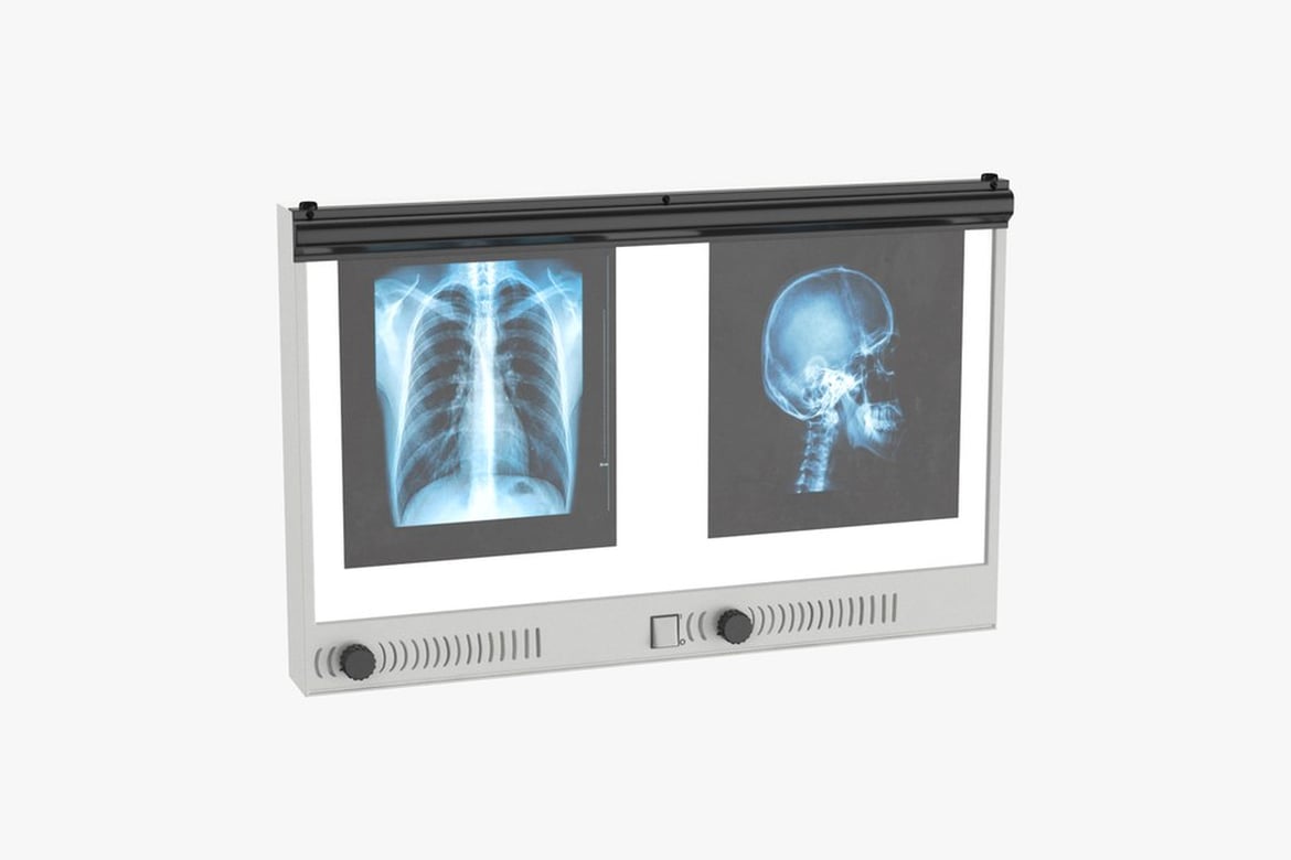 Download Xray Film Viewer, Medical Display Device with Chest and Skull Radiographs 3D Model